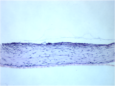Cornified Cells